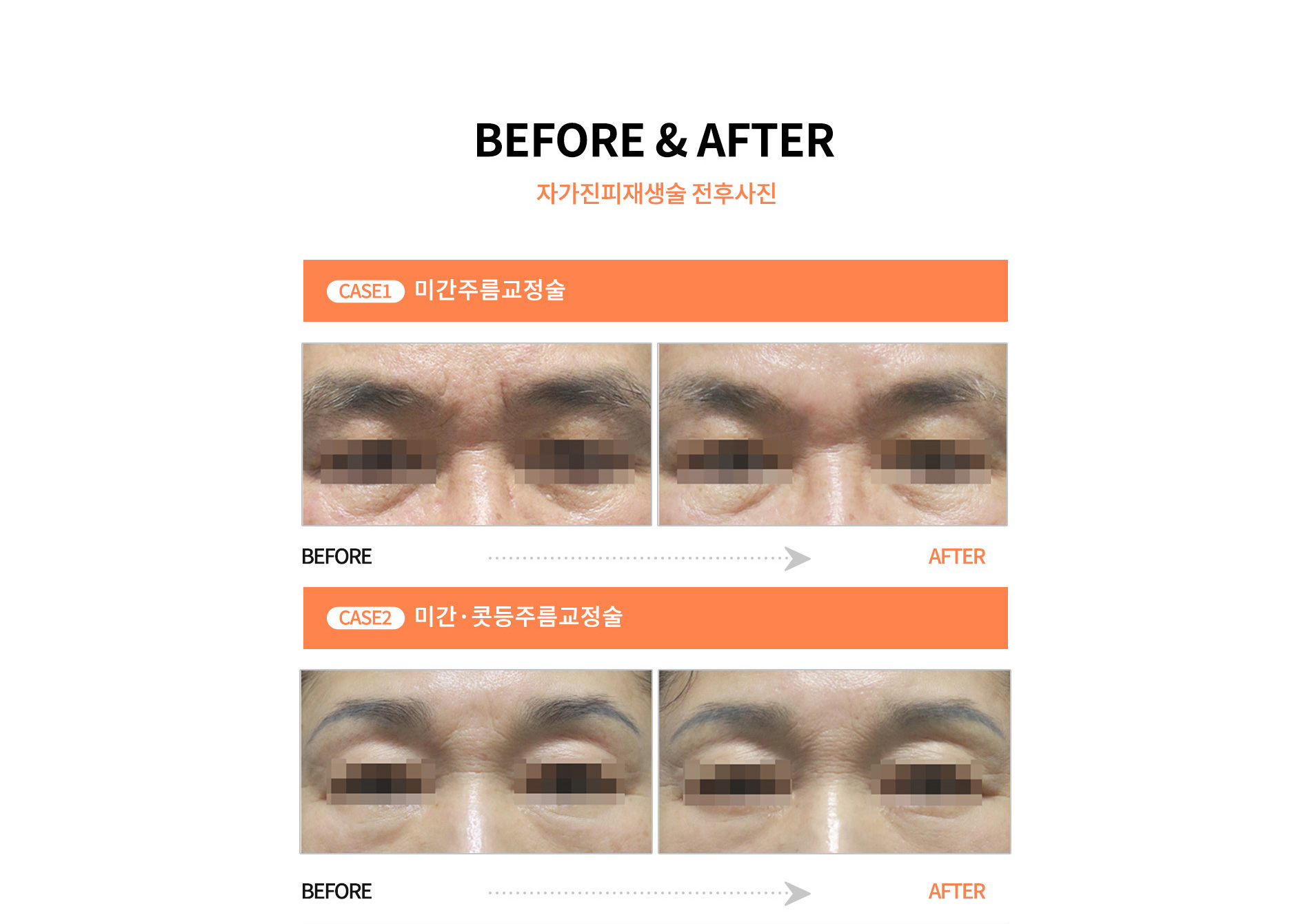 전후사진 1,2