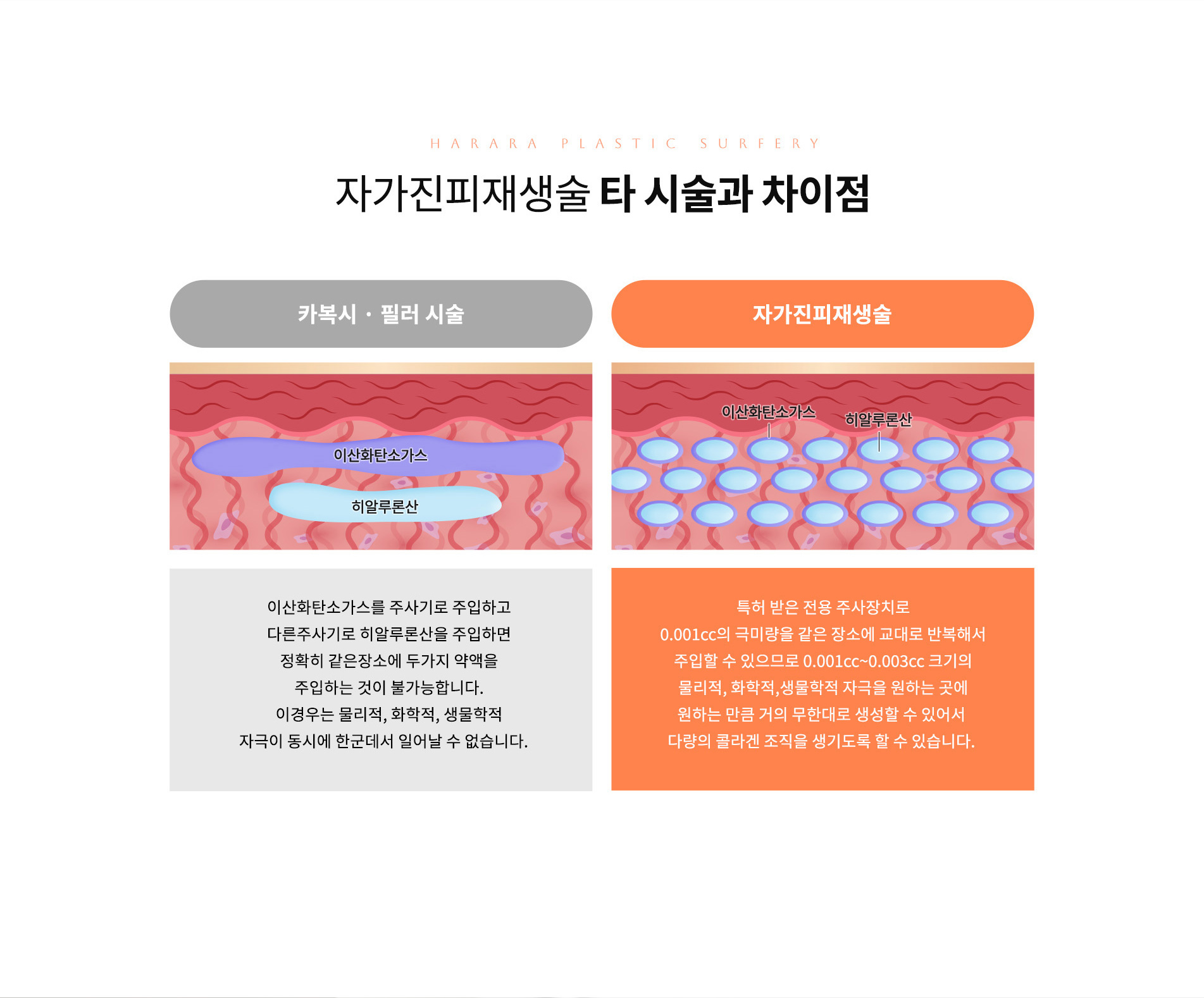 타시술과의차이점